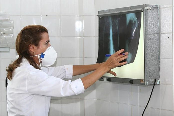 Brics tomarão a dianteira no combate à tuberculose? – Brasil de Fato