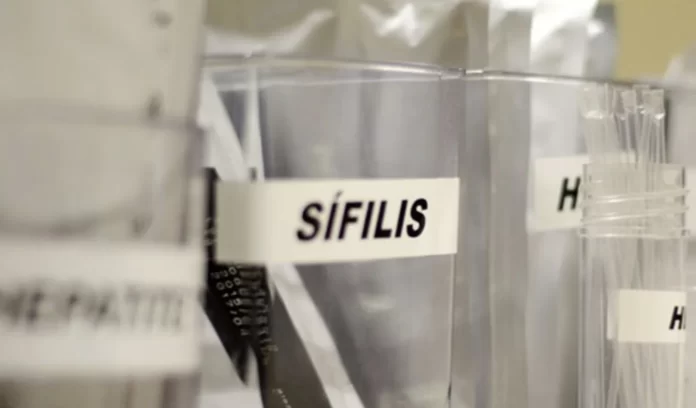 Imagem mostra tubo transparente onde estão depositados material usado para testar para sífilis